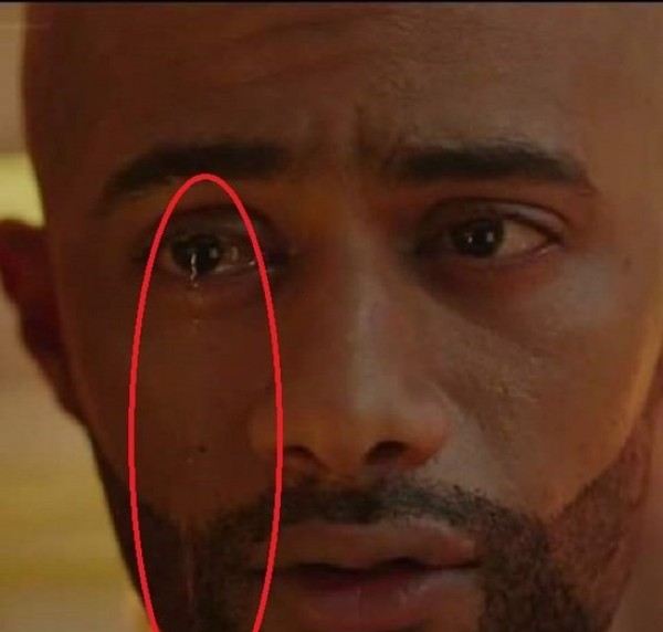 آثر هجمة الأسد في عين محمد رمضان بمسلسل الأسطورة عام 2016