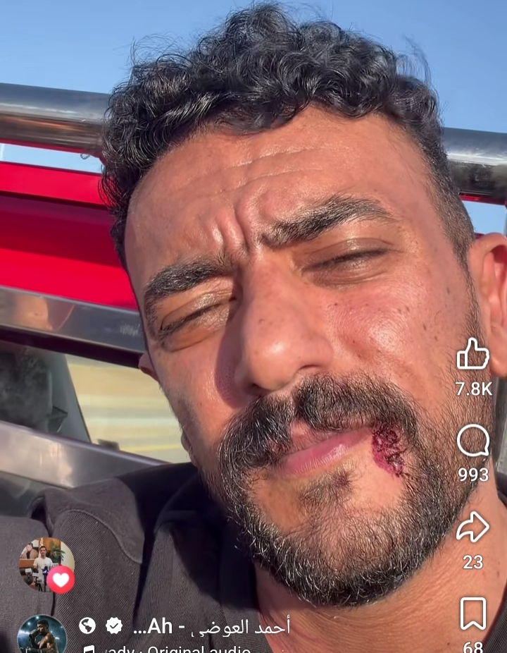 أحمد العوضي