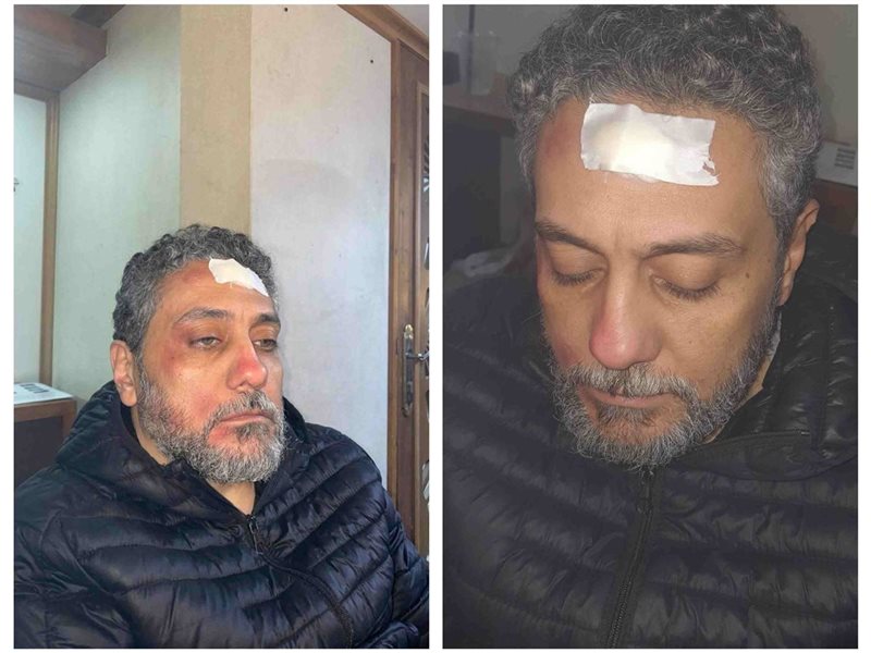 وحدة إضاءة وقعت عليه.. إصابة الفنان تامر فرج فى كواليس تصوير 