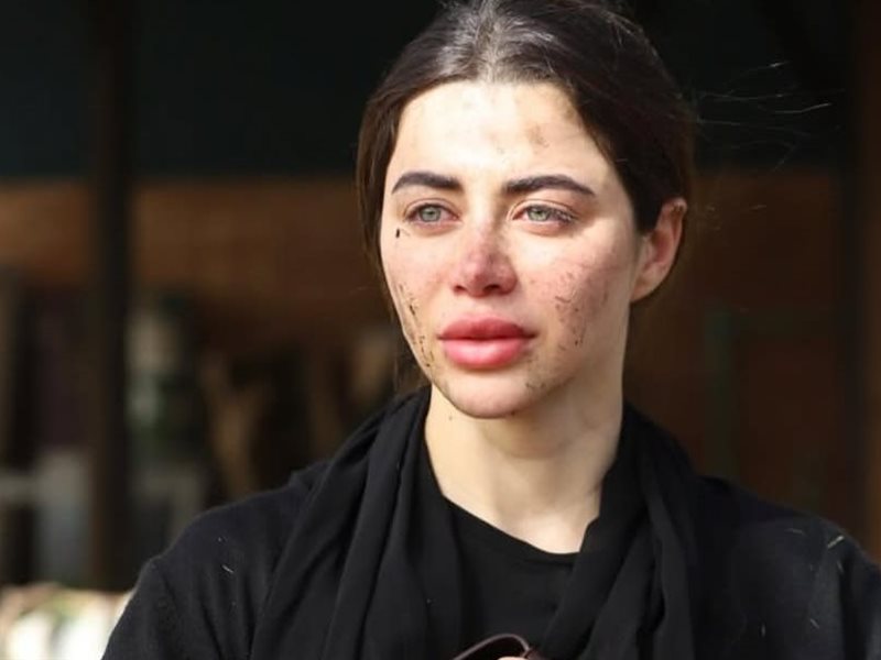 يارا السكري 