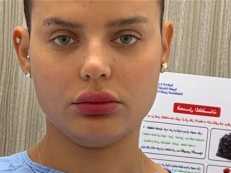 هبة السيسي تواجه السرطان بخطوة جديدة وتبدأ العلاج الإشعاعي